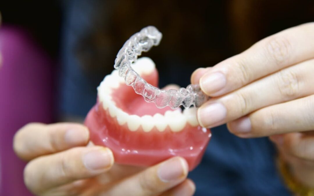Do I Need a Nightguard If I Grind My Teeth?