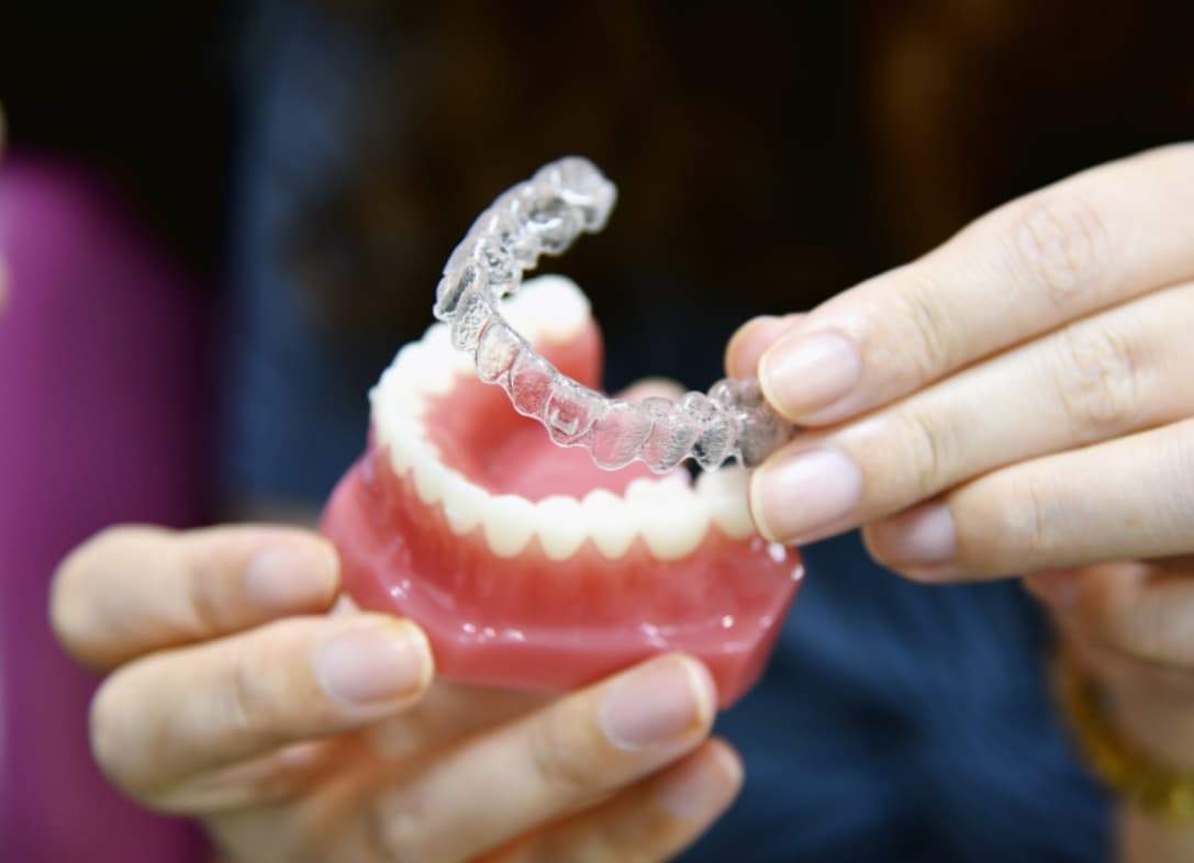 Custom dental nightguard shown on a model of teeth, demonstrating how a nightguard protects against teeth grinding and jaw clenching during sleep.