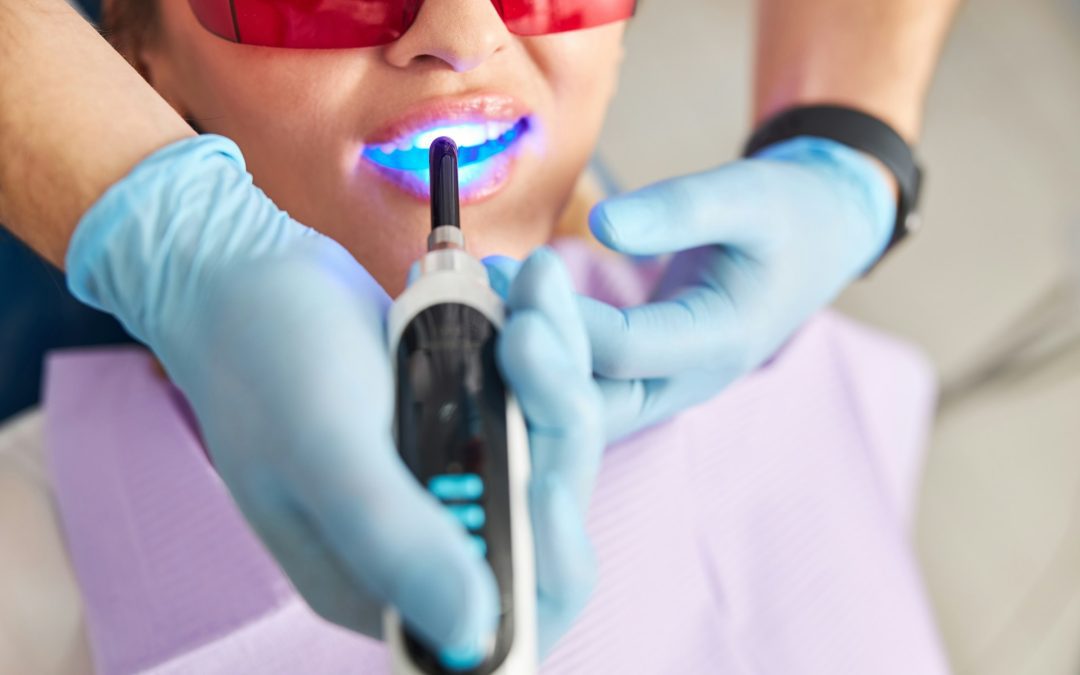 Quiet Dental Visits: Modern Dental Technology in Sterling, VA