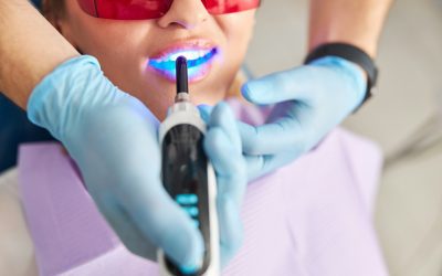 Quiet Dental Visits: Modern Dental Technology in Sterling, VA