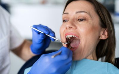 Signs Your White Tongue Needs a Dentist in Sterling, VA